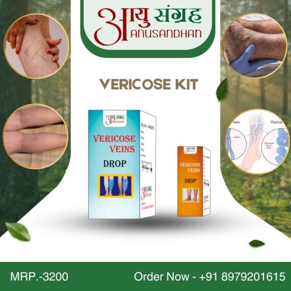 Vericose veins kit (What are Varicose Veins?)